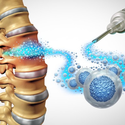 Mesenchymal Stem Cell Derived Extracellular Vesicles - OCTOBER | The American Chiropractor